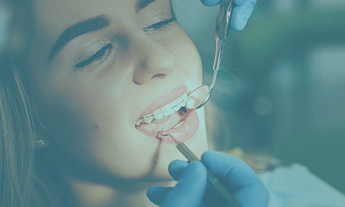 Tratamientos de ortodoncias