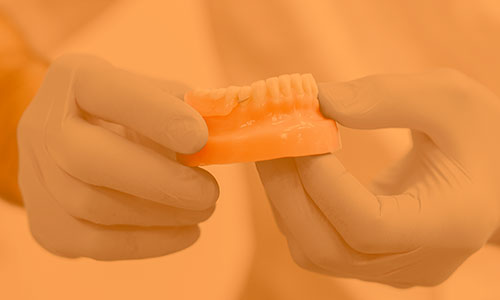 Tratamientos de prótesis dentales