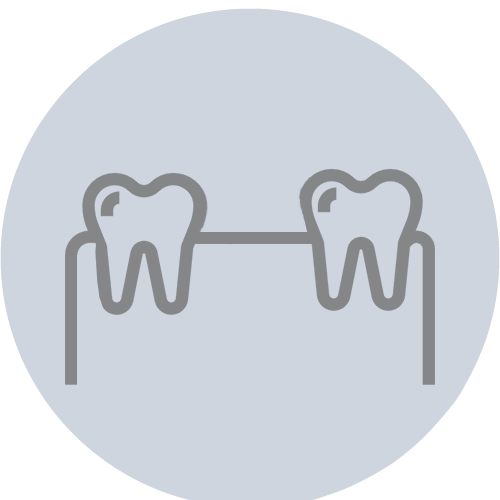 Separación de los dientes
