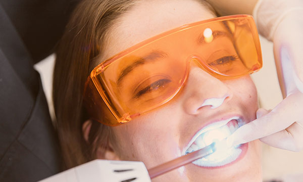 Estética dental Clínica Cuatro Parques